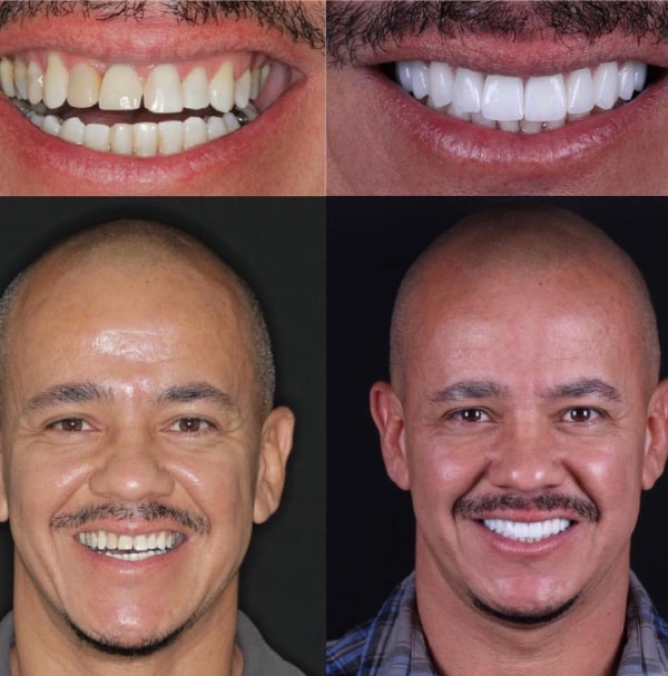 תמונת גלרייה - חלום בלבן