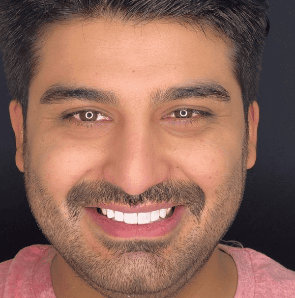 תמונת גלרייה - חלום בלבן