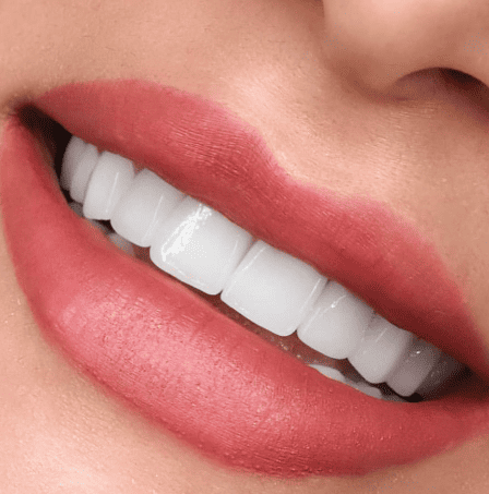 תמונת גלרייה - חלום בלבן