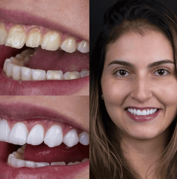 תמונת גלרייה - חלום בלבן