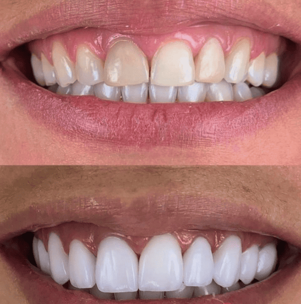 תמונת גלרייה - חלום בלבן