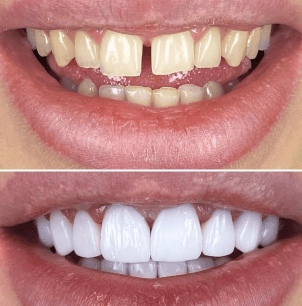 תמונת גלרייה - חלום בלבן