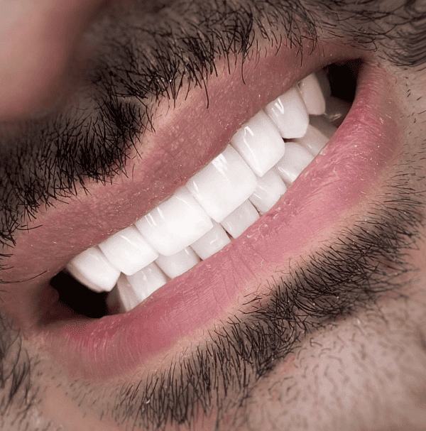 תמונת גלרייה - חלום בלבן