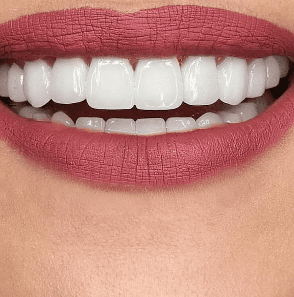 תמונת גלרייה - חלום בלבן