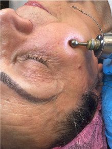 כרטיס ביקור דיגטלי ויקטוריה ריס - טיפול פנים